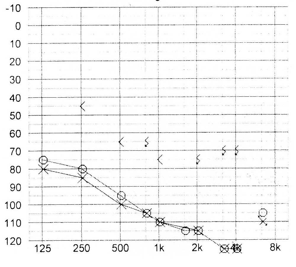 9B139 Audiogram Template | Wiring Library Pertaining To Blank Audiogram Template Download